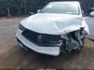 Acura TLX Tech   A-spec Pkgs Image 17